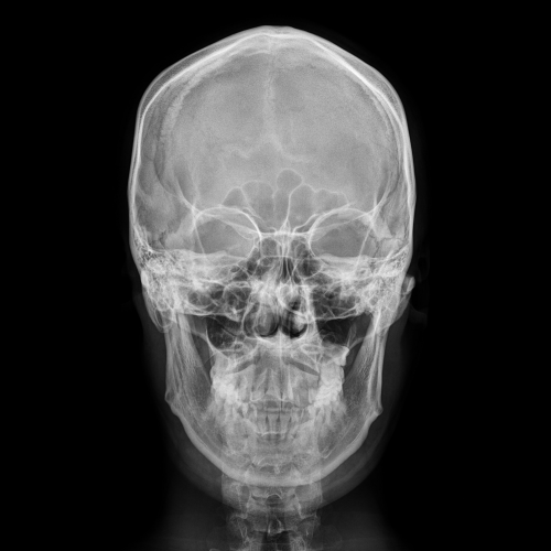 Coogie - Album Vol.2 : UPSET